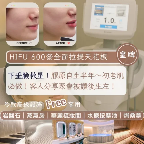 ✨首試半價體驗🔥即時輪廓超明顯｜Ultra Former 3 Hifu面部拉提｜🔥 600發全面緊致V面｜🧏🏻‍♀️ 蘋果肌歸位，立體輪廓｜免費嘆全館設施！