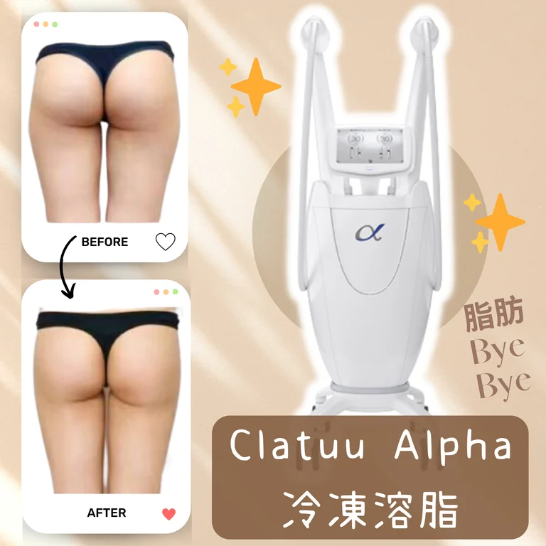 ✨體驗直減00！Clatuu Alpha冷凍溶脂｜🙆🏻 腰腹慢慢緊+大腿悄悄瘦 ｜無痛零復原期 坐住瘦都得 👀 日日見到體態變靚｜🔥 着衫更貼身 唔使再遮遮擋擋｜✨ 免費嘆全館Spa設施！